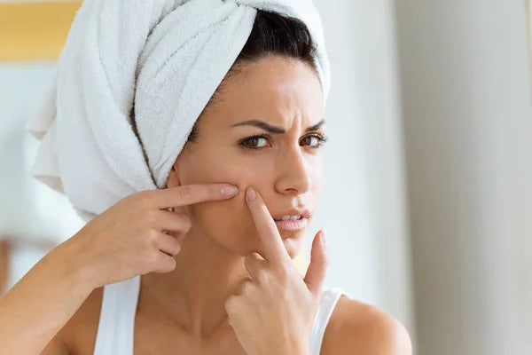 How Stress Affects Blackhead Formation and Removal